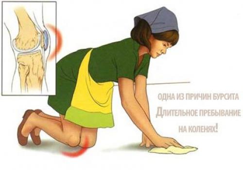 Можно ли греть колено при бурсите. Лечение бурсита коленного сустава в домашних условиях