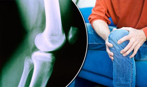 Растирка с анальгином и йодом. Бабушкина растирка: рецепт для суставов