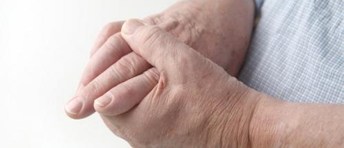 Косточки на пальцах рук. Причины возникновения шишек 01 Косточки на пальцах рук. Причины возникновения шишек 01