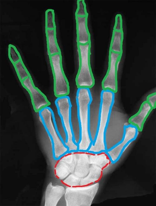 Связки кисти руки анатомия. Анатомия кисти. Строение костей кисти.