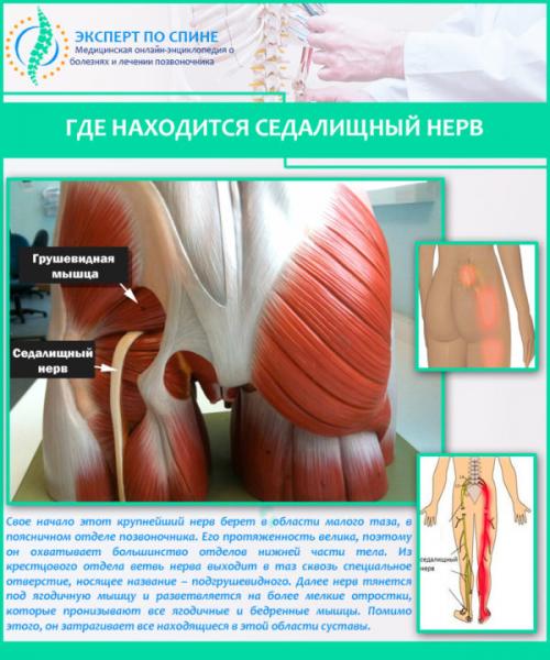 Защемление седалищного нерва симптомы. Симптомы и особенности заболевания