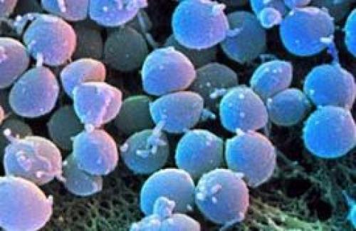 Примеры шаровидных клеток. Шаровидные бактерии