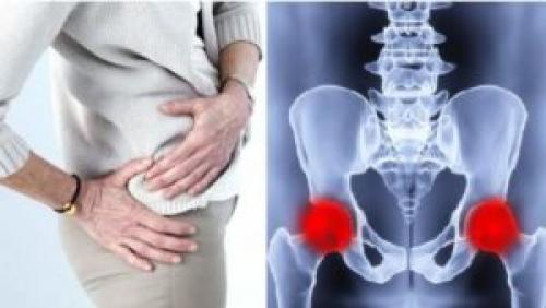 Тазобедренный сустав Фото рентгена здорового и больного человека с описанием. Строение и патологии +Видео