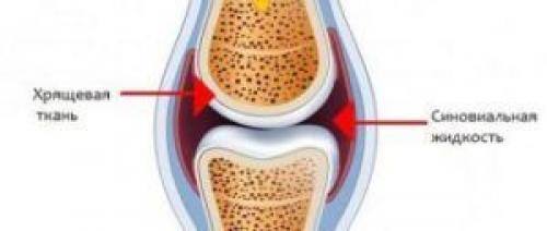 Как восстановить хрящевую ткань в суставах народные средства. Причины и последствия разрушения 01