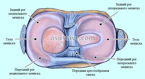Горизонтальный разрыв заднего рога и тела медиального мениска опасно ли это. Виды повреждений мениска коленного сустава: их обзор, степени, симптомы и лечение