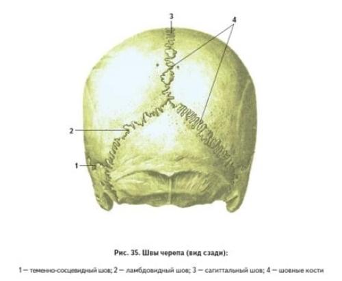 Швы черепа анатомия картинки