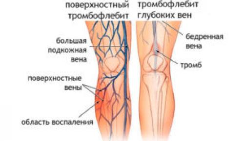 Горит кожа на коленях. Характер проблемы и причины ее возникновения