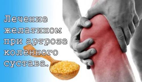 Желатин и лечение артроза суставов. Лечение желатином при артрозе, артрите