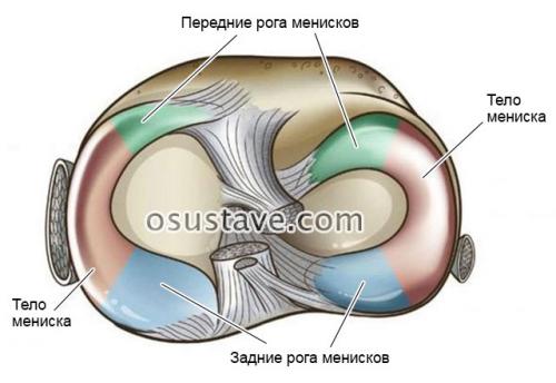 Повреждение медиального мениска коленного сустава симптомы и лечение. Что такое мениск коленного сустава, возможные повреждения, их причины и лечение