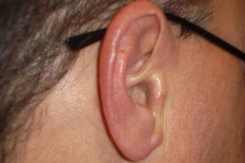 К чему горит правое ухо примета. К чему горит правое ухо от дня недели по времени суток