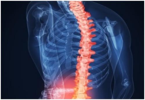 Лекарство для восстановления хрящевой ткани. Почему назначаются уколы? 06 Лекарство для восстановления хрящевой ткани. Почему назначаются уколы? 06