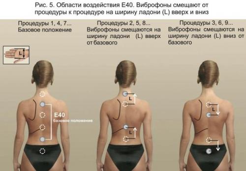 Инструкция лечение витафоном. Инструкции по применению аппаратов Витафон 08 Инструкция лечение витафоном. Инструкции по применению аппаратов Витафон 08