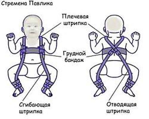 Дисплазия в 3 месяца. Лечение 02 Дисплазия в 3 месяца. Лечение 02