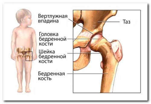 Нормы углов тазобедренных суставов по УЗИ. Что показывает УЗИ тазобедренных суставов у грудничков?