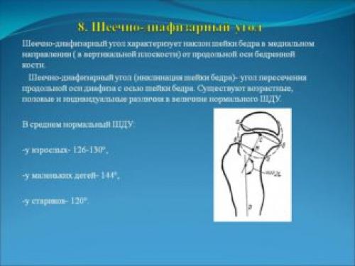 Нормы углов тазобедренных суставов по рентгену. Углы тазобедренного сустава и их нормы у детей