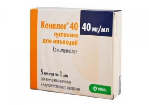 Артроз коленного сустава лечение препараты. Препараты при артрозе, глюкокортикостероиды