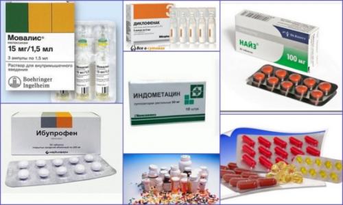 От болей в суставах свечи. Почему возникает боль в спине? 13