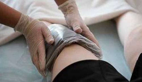 Эффективность компресса с Димексидом, Новокаином и Дексаметазоном: оптимальные пропорции 05 Эффективность компресса с Димексидом, Новокаином и Дексаметазоном: оптимальные пропорции 05