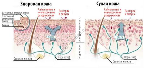 Обезвоженная кожа лица, что делать в домашних условиях. Сухая кожа – в чем причины?