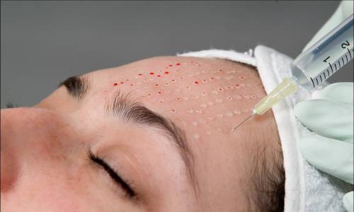 Правильное увлажнение кожи лица. Как эффективно увлажнить кожу лица в домашних условиях? 06 Правильное увлажнение кожи лица. Как эффективно увлажнить кожу лица в домашних условиях? 06