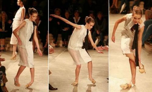 Методы восстановления хрящей коленного сустава. Факторы риска, повышающие вероятность развития гонартроза: 02