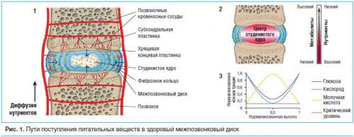 Как восстановить хрящевую ткань тазобедренного сустава. Эффективны ли хондропротекторы