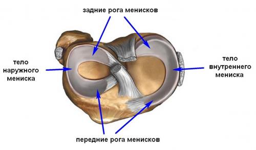 Разрыв заднего рога медиального мениска нужна ли операция. Строение менисков и их функции
