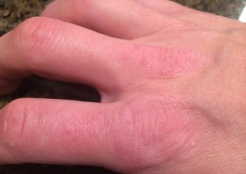 Рекомендации по уходу за сухой кожей лица. Уход за сухой кожей лица: главные правила и лучшие средства 08