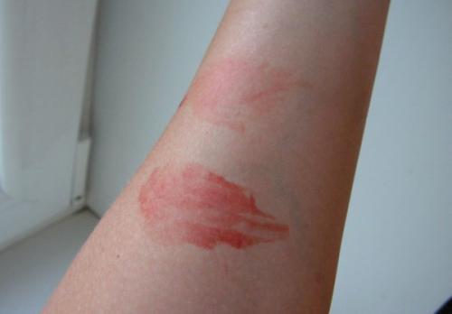 Какие профессиональные косметические средства помогут убрать краску для волос с рук. Как оттереть краску для волос с кожи лица, рук или других частей тела