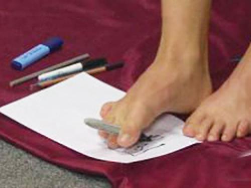 Шишка на суставе мизинца: причины, симптомы и лечение 08