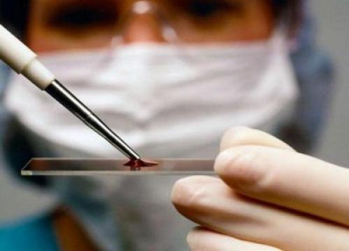 Стоит ли удалять липомы. Как лечить липомы? 04