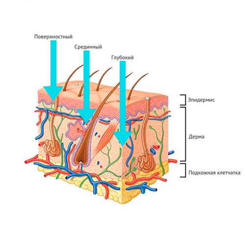 Как ухаживать за кожей после пилинга. Главные принципы ухода за кожей после пилинга химического 04