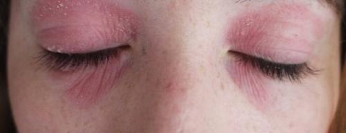 Грамотный уход за кожей вокруг глаз. Все об уходе за кожей вокруг глаз 04