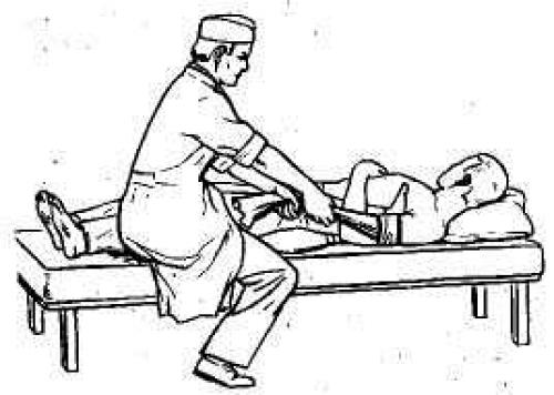 Импрессионный перелом хилл-сакса лечение. Нестабильность плечевого сустава