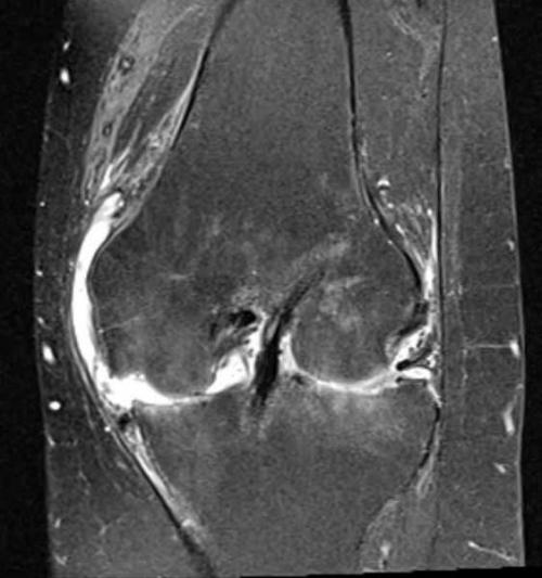 Видеоанатомия коленного сустава: подробное исследование 01