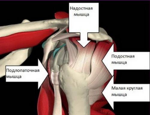 Отложение соли в суставах. Тревожные симптомы 04 Отложение соли в суставах. Тревожные симптомы 04