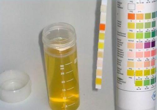 Как вывести лишнюю соль из организма. Почки 02