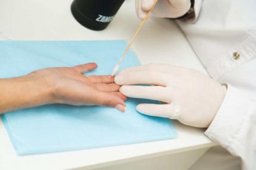 Какие культуры используют шишку на указательном пальце. Образование шишек и наростов на пальцах рук: причины, симптомы и лечение