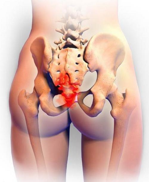 Лечение отложений солей в суставах. Отложение солей в плечевом суставе 02