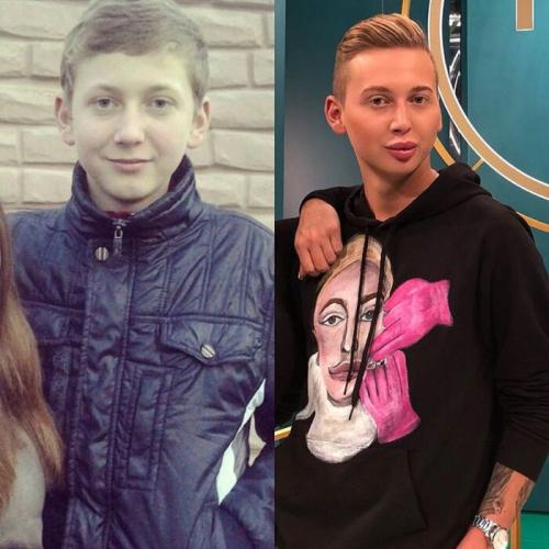 Большие скулы инстаграм. Как живется «Украинке с самыми большими скулами» — фото до пластики и что с ее личной жизнью