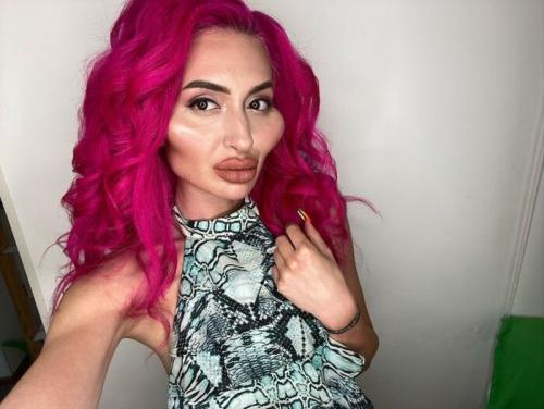 Большие скулы инстаграм. Как живется «Украинке с самыми большими скулами» — фото до пластики и что с ее личной жизнью