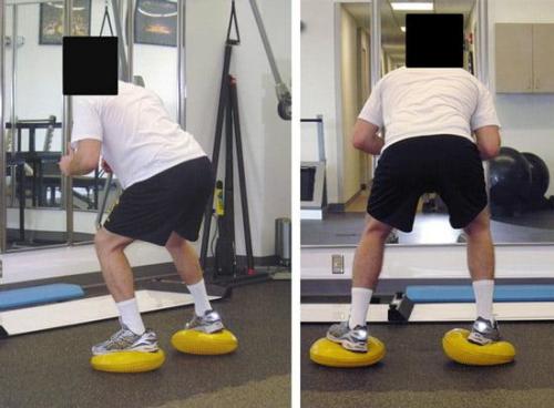 Сколько времени занимает восстановление после операции на латеральном мениске. Артроскопическая процедура