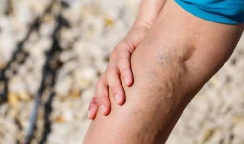 Повреждения связок коленного сустава. Виды и терапия повреждений связок коленного сустава 05