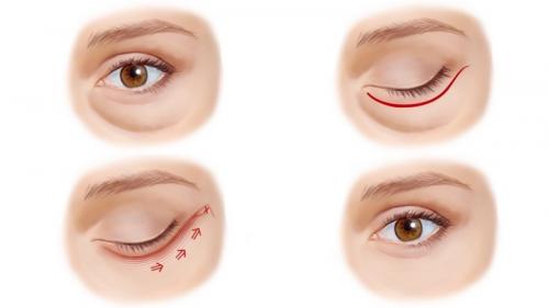 15 способов уменьшить темные круги под глазами. Почему появляются темные круги под глазами 04