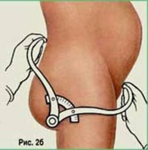 Размеры таза норма для родов. Как измеряют малый таз?