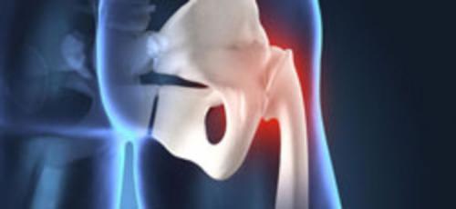 Что показывает УЗИ тазобедренного сустава. Как делают УЗИ тазобедренных суставов? 03