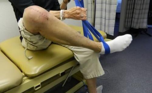 Реабилитация после эндопротезирования коленного сустава клинические рекомендации. Замена коленного сустава, реабилитация после операции