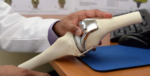 4 причины не спешить с эндопротезированием. Почему не стоит тянуть с эндопротезированием суставов 02 4 причины не спешить с эндопротезированием. Почему не стоит тянуть с эндопротезированием суставов 02