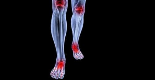 Что важно знать о суставах. Особенности суставов и причины их заболеваний 02 Что важно знать о суставах. Особенности суставов и причины их заболеваний 02