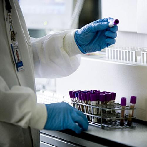 Сахарный диабет: необычные симптомы, которые стоит знать 02